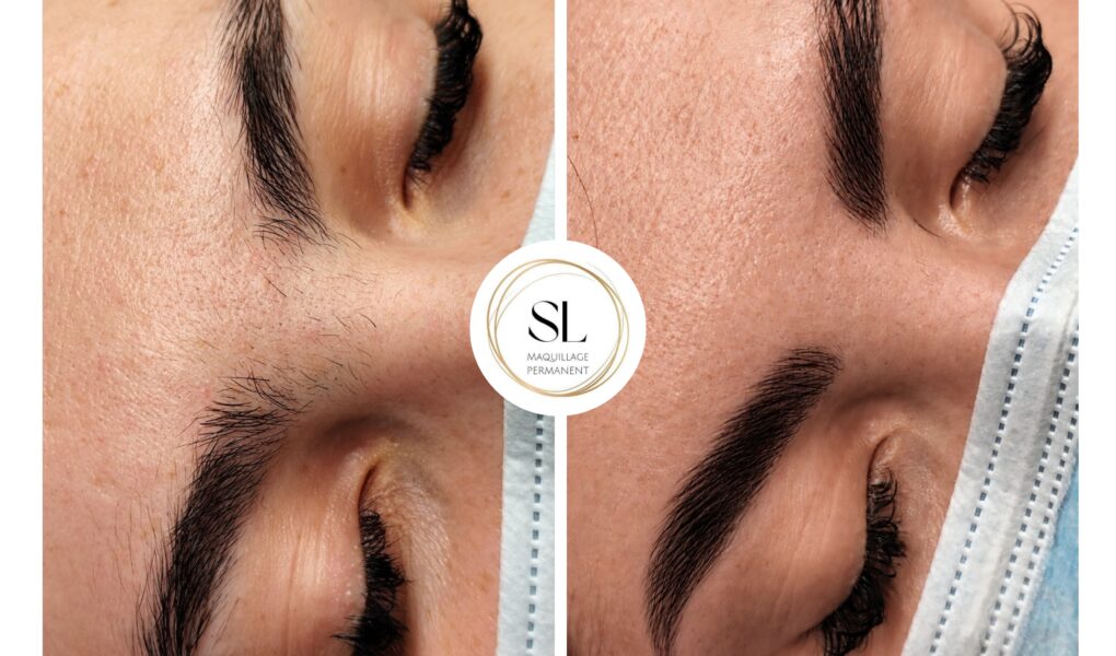 Résultats de Brow Lift Bayonne